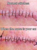 When the nurse is your ex - poza demo